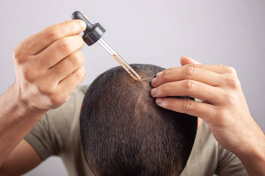 Is Minoxidil Safe? Understanding Side Effects and How to Avoid Them